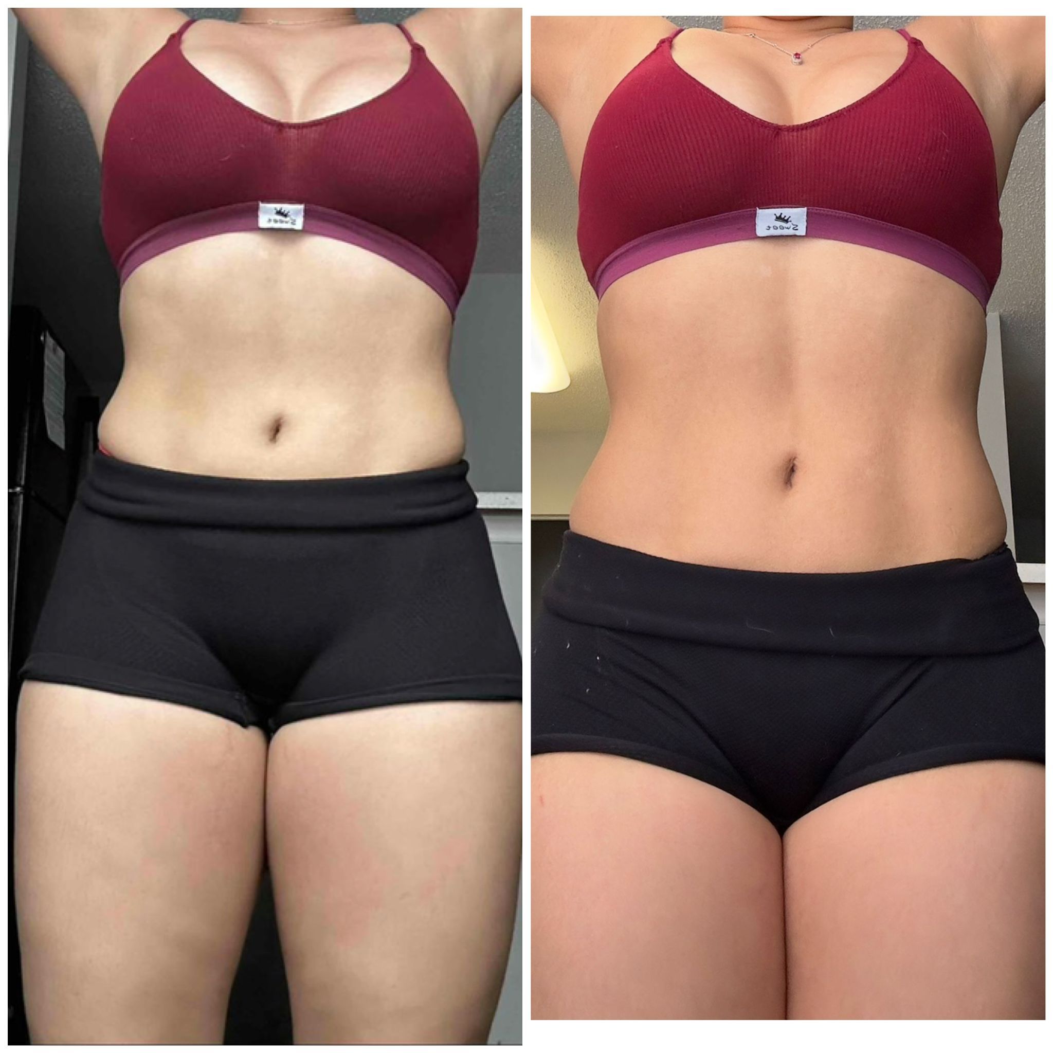 Before After photo 12