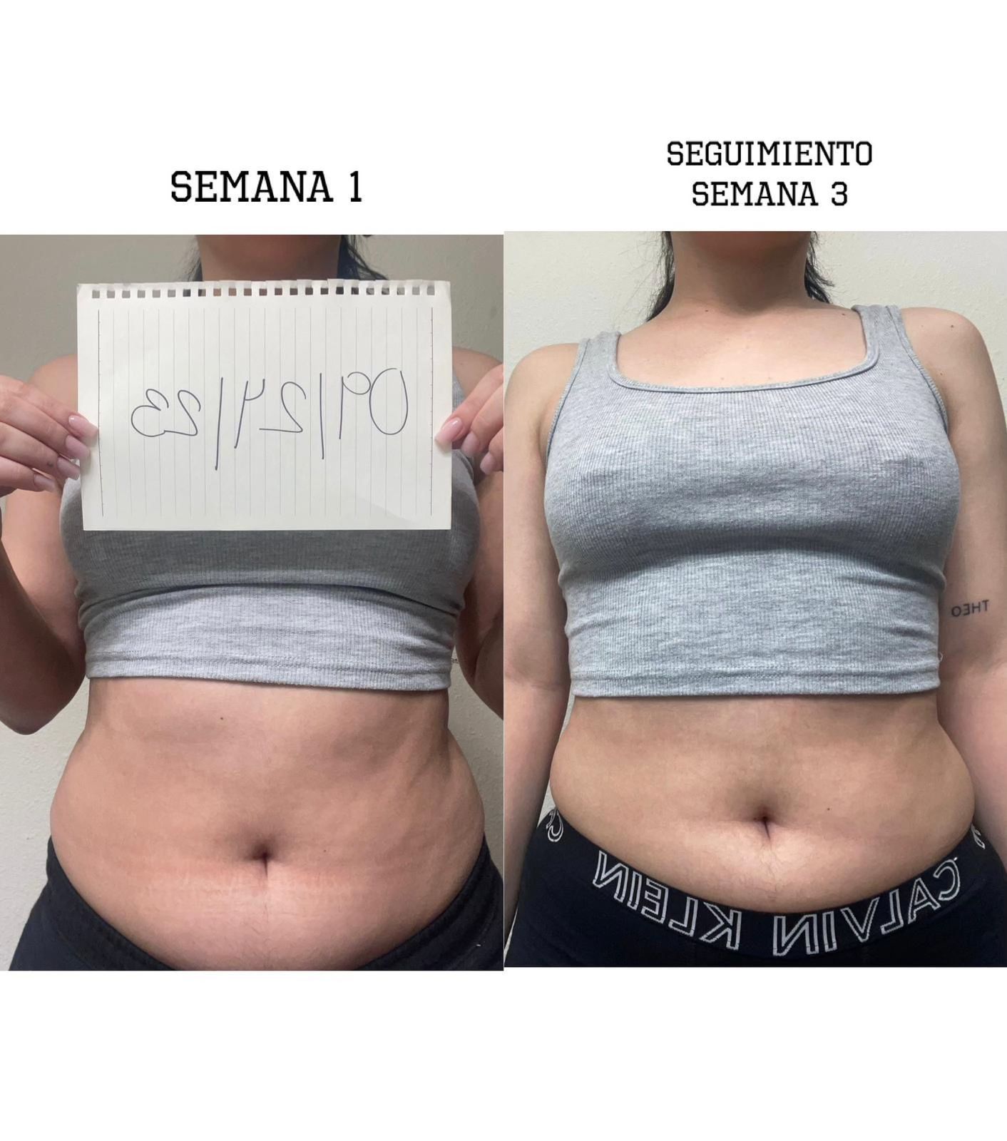 Before After photo 3