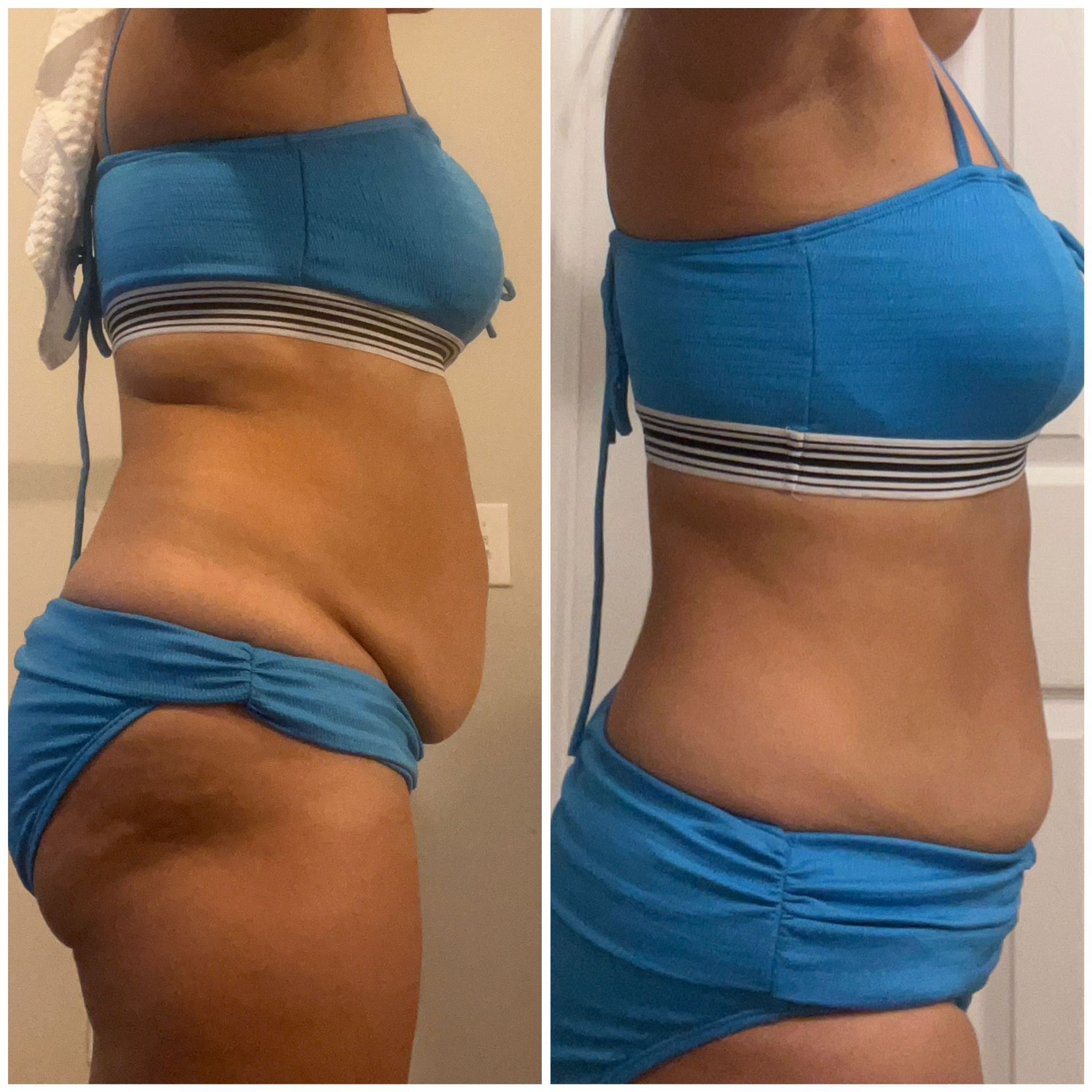 Before After photo 14